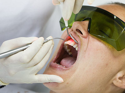 Forest Hills Plastic Surgery | Sedation Dentistry, CEREC and Fluoride Treatment