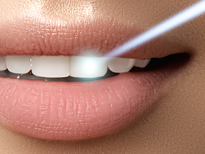 Forest Hills Plastic Surgery | Cosmetic Dentistry, Emergency Treatment and Fluoride Treatment